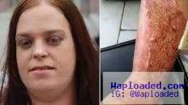 Jealous Boyfriend Jailed After Pouring Boiling Water Mixed With Sugar Over Pregnant Partner